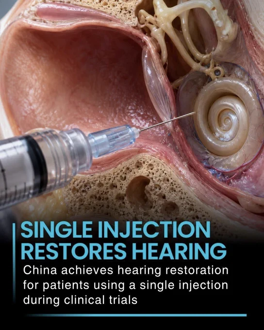 🚨 HEARING RESTORED WITH JUST ONE INJECTION? 

What sounds like science fiction may be becoming reality. Chinese researchers report that a single injection into the inner ear helped some patients regain hearing by repairing damaged cells responsible for hearing loss.

The results are exciting, but here's the mystery: could this be the first step toward reversing hearing loss instead of simply managing it?

Source:
Wu, X., et al. *Nature Medicine*.