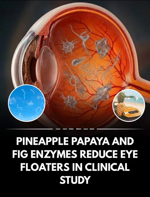 A groundbreaking 2022 study published in the Journal of Clinical Medicine tested whether natural fruit enzymes could actually reduce those annoying eye floaters that cloud your vision. Researchers conducted a rigorous randomized, double-blind, placebo-controlled trial with 224 patients aged 30-60 who had symptomatic vitreous opacities caused by vitreous degeneration or hemorrhage.

For three months, participants took capsules containing bromelain from pineapple (190 mg), papain from papaya (95 mg), and ficin from fig (95 mg) at doses of 1-3 capsules daily. These proteolytic enzymes specifically target the protein deposits that create those floating specks and clouds in your visual field. The study design was as rigorous as it gets in medical research, eliminating bias and placebo effects.

The results showed genuine potential for oral mixed fruit enzymes to reduce eye floaters naturally.