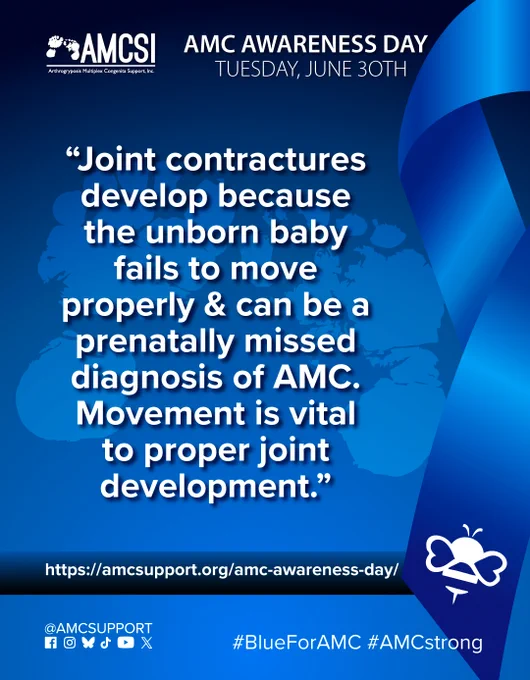 The AMCSI logo is small, white, in the upper-left corner & the background is a dark blue-to-blue circular gradient. It says ‘AMC AWARENESS DAY TUESDAY, JUNE 30TH’ in white, big lettering next to the AMCSI logo, with a ghosted image of teh AMCSI logo feet and the AMC Fact “Joint contractures develop because the unborn baby fails to move properly & can be a prenatally missed diagnosis of AMC. Movement is vital to proper joint development.” written above everything, in bold white lettering, with a large blue ribbon on the right & the white bumblebee on the bottom left corner of it. Near the bottom is a blue-to-dark-blue gradient bar that runs behind the ribbon on the right & all the entire width, with the AMC Awareness Day AMCSI website link "https://amcsupport.org/amc-awareness-day/" in bold white lettering across it. At the bottom right are the logos of Facebook, Instagram, BlueSky, TikTok, YouTube, and X. The text "@AMCSUPPORT" is located above them, on the bottom left, and the hashtag