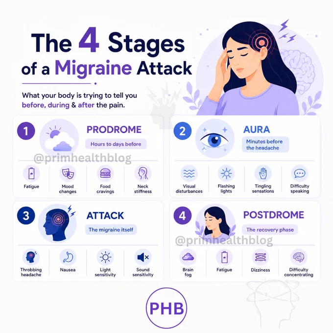 Infographic illustrating the 4 stages of a migraine attack — Stage 1 Prodrome (fatigue, mood changes, food cravings, neck stiffness), Stage 2 Aura (visual disturbances, flashing lights, tingling sensations, difficulty speaking), Stage 3 Attack (throbbing headache, nausea, light and sound sensitivity), and Stage 4 Postdrome (brain fog, fatigue, dizziness, difficulty concentrating). Created by PHB — Prim Health Blog."

Short Alt Text:
"The 4 stages of a migraine attack infographic — Prodrome, Aura, Attack, and Postdrome — with symptoms listed for each phase. By PHB."