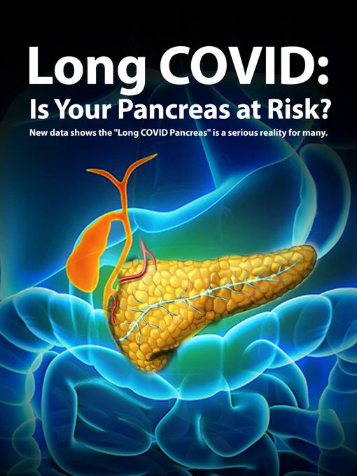 Visual, a picture of the pancreas in the center of a body.
Long COVID: Is Your Pancreas at Risk?
New data shows the "Long COVID Pancreas" is a serious reality for many.