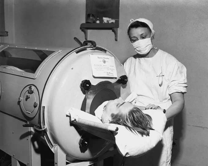 Black and white photo of Herbert Bish in an Emerson Iron Lung, Los Alamitos, 1949