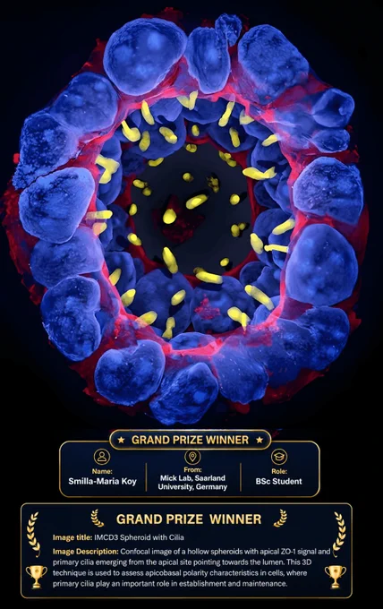 Confocal image of a hollow spheroids with apical ZO-1 signal and primary cilia emerging from the apical site pointing towards the lumen. This 3D technique is used to assess apicobasal polarity characteristics in cells, where primary cilia play an important role in establishment and maintenance. 
