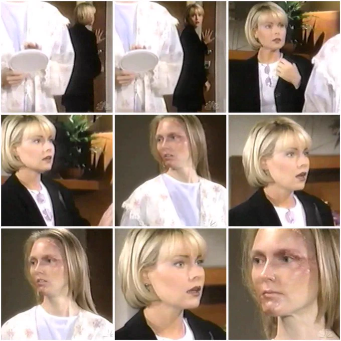 Vicky and Marley come face-to-face for the first time since Marley’s bandages were removed on NBC soap opera Another World