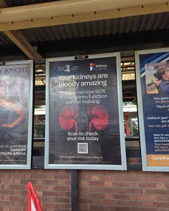The image shows an advertisement poster from Kidney Care UK at a train station. The poster features an illustration of kidneys and text that reads: "Your kidneys are bloody amazing. But you can lose 90% of your kidney function without realizing." Below is a call to action to scan and check kidney risk, along with a QR code. The top left of the poster displays the logos of Kidney Wales. To the left and right of the poster are additional posters for events and attractions.