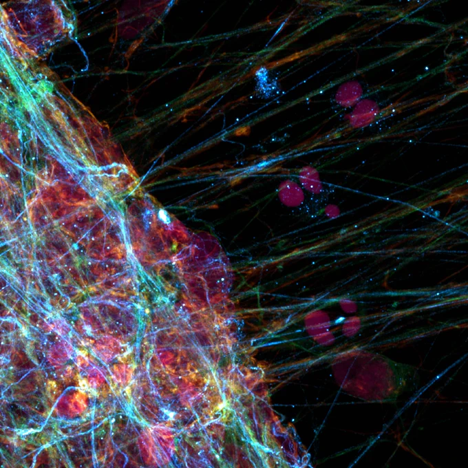 Microscopic image showing a vibrant, multicolored tangle of neurons and glia. The colors include bright blues, reds, greens, and purples, highlighting different structures and connections within the neural network.
