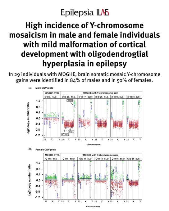 "The combined presence of Y-chromosomal material in females, mosaic Y-chromosome gains in males, and SLC35A2 variants represents a recurrent genomic feature in patients with MOGHE. These findings suggest that sex-chromosome anomalies may contribute to the pathobiology of this epilepsy-associated cortical malformation, highlighting the need to clarify the underlying molecular mechanisms of this clinicohistopathologic entity. Although the root cause, biological consequence, and clinical significance of brain somatic Y-chromosomal gain remain to be further clarified, our findings identify a previously unrecognized genomic feature of MOGHE and provide a rationale for future research in MOGHE cohorts."

Read this open-access research article from Epilepsia Journal at doi.org/10.1002/epi.70317.