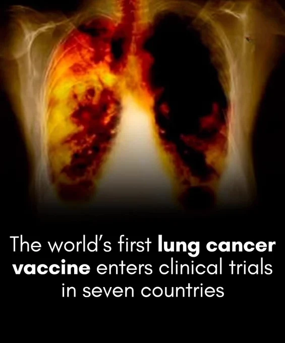In the United States, lung cancer is the leading cause of cancer death. Soon, that may change — a lung cancer vaccine has officially entered human trials. 

A groundbreaking global trial of the world's first mRNA lung cancer vaccine has officially launched, offering a personalized, targeted weapon against the deadliest form of the disease.

Doctors have officially initiated human trials for BNT116, the world’s first mRNA lung cancer vaccine targeting non-small cell lung cancer (NSCLC), which is the most common and deadliest form of the disease. Developed by BioNTech, the investigational therapy utilizes the same messenger RNA technology that successfully powered COVID-19 vaccines. However, instead of fighting viruses, this jab is engineered to deliver precise genetic instructions that train the patient's immune system to identify and destroy tumor cells while sparing healthy surrounding tissues from the harsh side effects associated with traditional chemotherapy.