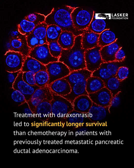 "Treatment with daraxonrasib led to significantly longer survival than chemotherapy in patients with previously treated metastatic pancreatic ductal adenocarcinoma." [This image shows pancreatic cancer cells (nuclei in blue) growing as a sphere encased in membranes (red). By growing cancer cells in the lab, researchers can study factors that promote and prevent the formation of deadly tumors. Credit: Min Yu (Eli and Edythe Broad Center for Regenerative Medicine and Stem Cell Research at USC), USC Norris Comprehensive Cancer Center, Pancreatic Desmoplasia.]