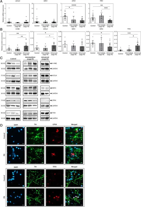 Figure from Annals of Neurology paper on ferroptosis in Parkinson's disease