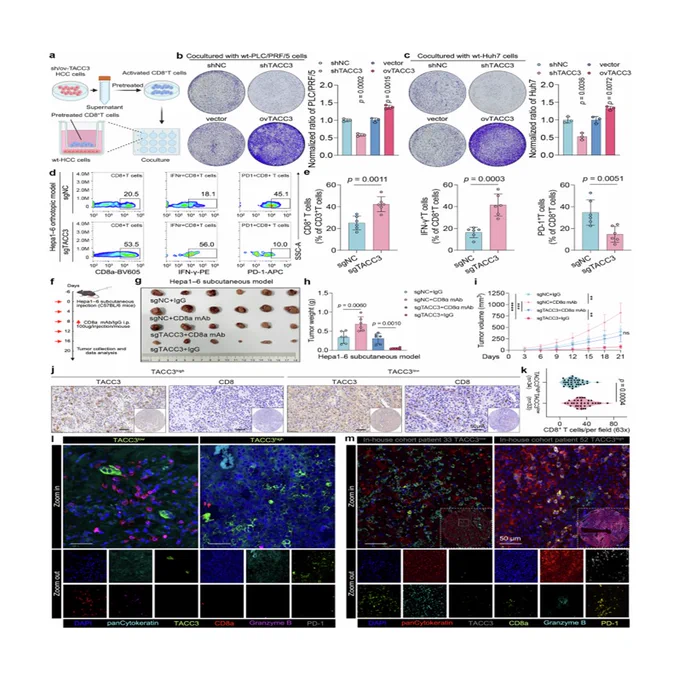 Transforming acidic coiled-coil-containing protein 3-mediated lipid metabolism reprogramming impairs CD8  T-cell cytotoxicity in hepatocellular carcinoma
