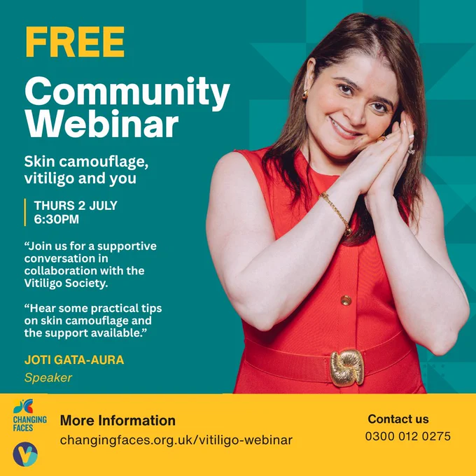 graphic features an image of Joti, a south asian woman with vitiligo. it reads: "free community webinar: Skin camouflage, vitiligo and you. Thursday 2 July, 6:30pm. more information online.