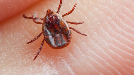 Close-up of a small tick attached to human skin, showing detailed body and legs.