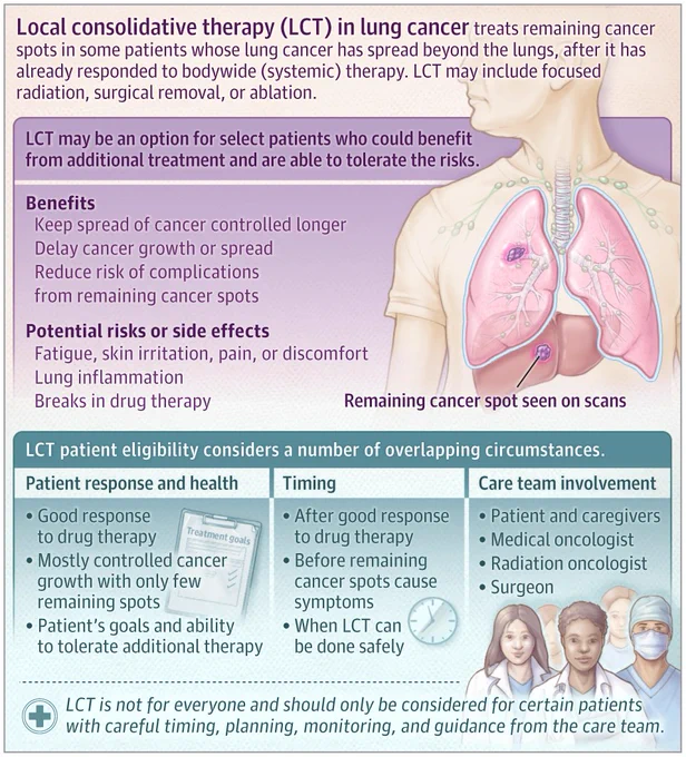 Local consolidative therapy (LCT) in lung cancer is explained. A human torso diagram shows lungs with cancer spots and a liver spot. Text outlines LCT benefits (control spread, delay growth), risks (fatigue, lung inflammation), eligibility (good response, few spots), timing, and care team involvement. LCT requires careful patient selection.