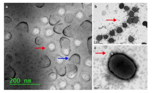 ransmission electron micrographs of M. album BG8 with released S-layer protein units (as depicted with arrows) when cultured with methane in various media conditions. (a) NMS medium, (b) AMS medium without copper, and (c) NMS medium with 50× trace elements solution. Micrographs contain a wide range of scales to highlight membrane morphology and adjacent surrounding areas.
