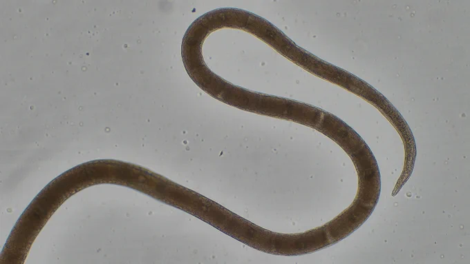 A microscopic close-up of a new species of parasitic nematode that graduate student Alex Nelson found while dissecting a snake.
