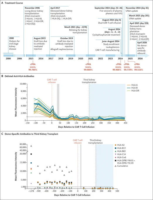This image presents a detailed timeline and graphs related to treatment course and anti-HLA antibody levels in Patient 1. A) Treatment Course Timeline: Shows the treatment course and calculated panel-reactive antibody (cPRA) scores before and after the infusion of chimeric antigen receptor (CAR) T cells in Patient 1. B) Delisted Anti-HLA Antibodies Graph: Displays levels of antibodies to HLA antigens that were eventually delisted in the patient, before and after the CAR T-cell infusion. C) Donor-Specific Antibodies to Third Kidney Transplant Graph: Shows levels of donor-specific antibodies to the third kidney transplant before and after the CAR T-cell infusion.   