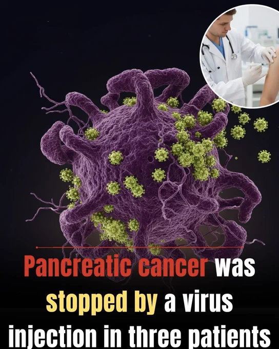 🚨 **Scientists Injected a Virus Into Cancer Tumors... Then Something Incredible Happened**

A specially engineered virus was injected into pancreatic tumors in an early clinical trial. The virus targeted cancer cells, destroyed them from the inside, and triggered the body's immune system to fight back.

In three patients, tumor growth stopped and the cancer showed no signs of spreading — even though they received only a small portion of the intended dose.

It's still early research, but this surprising breakthrough could open a new chapter in the fight against one of the deadliest cancers.

Source: Klein, A. *Pancreatic cancer halted by virus injection in three patients*. New Scientist.