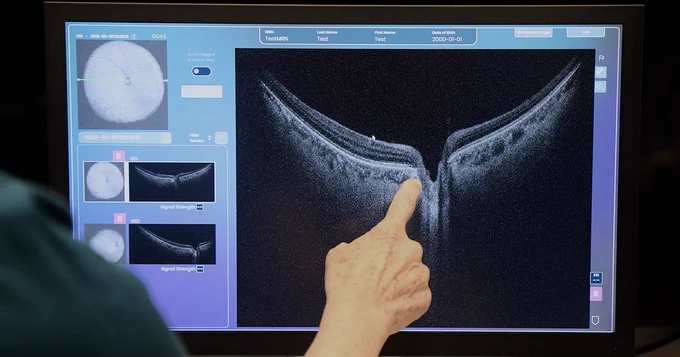 A Duke Health clinician points at a medical imaging screen showing detailed scans of an eye. The display includes multiple views and data related to the eye examination.