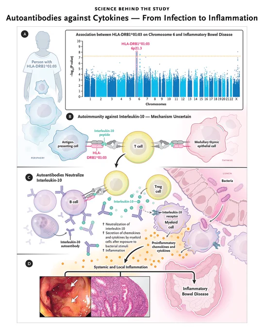 The image is a detailed infographic from the editorial "Autoantibodies against Cytokines — From Infection to Inflammation." It visually explains HLA risk allele and autoantibodies against interleukin-10 in inflammatory bowel disease. 