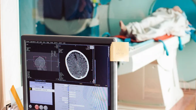 Stock photo of an MRI machine with patient and screen in the foreground.
