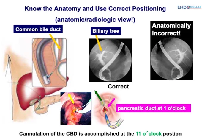 Know the Anatomy and Use Correct Positioning