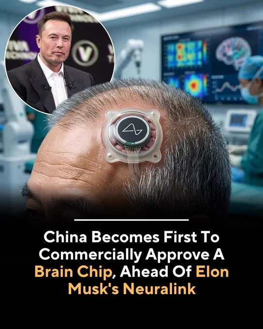 China has officially approved the world’s first commercially available brain-computer interface implant for medical use. This historic milestone marks a massive leap forward for neurotechnology, opening up incredible new possibilities for advanced patient care worldwide.

The pioneering device is specifically designed to help individuals with paralysis regain their mobility and independence. By translating complex brain signals into physical actions, it offers life-changing potential for millions of people living with severe motor impairments.

With this regulatory green light, the device has officially achieved commercial approval ahead of Elon Musk’s highly anticipated Neuralink. While Neuralink remains in the clinical trial phase, this new implant is ready to transform the medical market.
