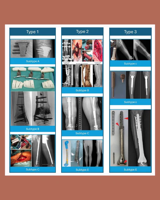 Image depicts classification examples of nine different types of custom implant.