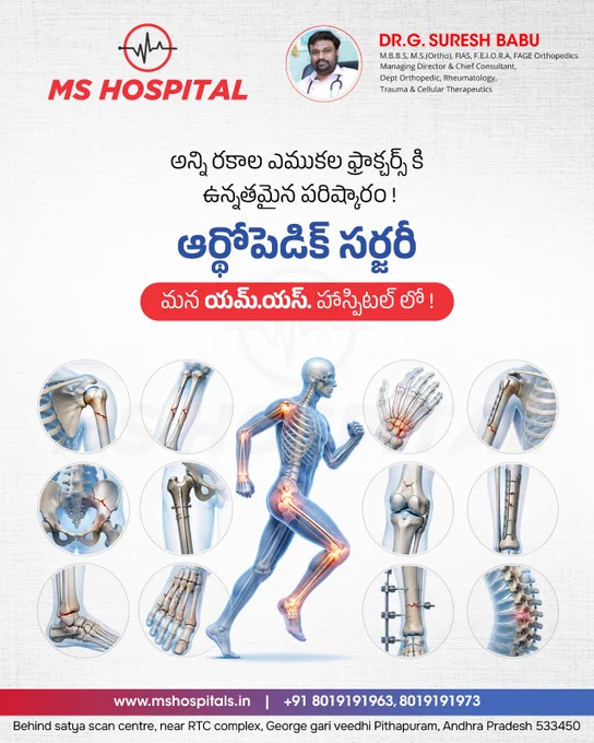 అనుకోకుండా జరిగే ప్రమాదాలు, ఎముకల ఫ్రాక్చర్స్ (Fractures) మిమ్మల్ని ఆందోళనకు గురిచేస్తున్నాయా?

చింతించకండి! అన్ని రకాల ఎముకల ఫ్రాక్చర్స్‌కి అత్యున్నతమైన పరిష్కారం ఇప్పుడు మన యమ్.యస్. హాస్పిటల్ (MS Hospital) లో అందుబాటులో ఉంది. అత్యాధునిక ఆర్థోపెడిక్ సర్జరీ (Orthopedic Surgery) విధానాల ద్వారా మీ ఎముకల ఆరోగ్యానికి మళ్లీ పూర్వ వైభవాన్ని అందిస్తాము.

ప్రముఖ నిపుణులు డాక్టర్ జి. సురేష్ బాబు గారి ఆధ్వర్యంలో నమ్మకమైన, అనుభవజ్ఞులైన వైద్య సేవలను అందుకోండి. 🧍‍♂️✨

👨‍⚕️ DR. G. SURESH BABU
(M.B.B.S, M.S.(Ortho), FIAS, F.E.I.O.R.A, FAGE Orthopedics)
Managing Director & Chief Consultant
Dept of Orthopedic, Rheumatology, Trauma & Cellular Therapeutics

Visit website: https://www.mshospitals.in/
Or call for appointments:  91 80191 91963,  91 80191 91973

Follow us on our social media pages for more details:
https://www.instagram.com/ms_hospitals/
https://www.facebook.com/MSMultiSpeciality/

#MSHospital #DrGSureshBabu #OrthopedicSurgery #FractureTreatment #PithapuramHospitals #OrthoCare 