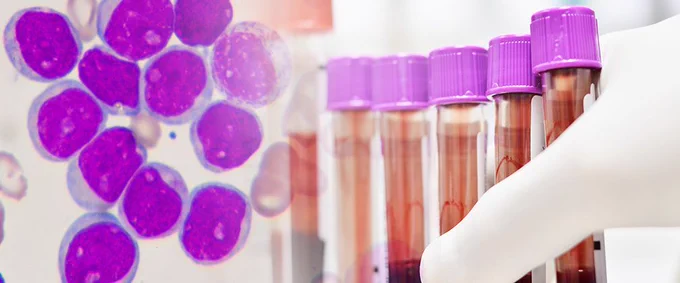 a picture representing the recently opened #myeloMATCH clinical trial, #CCTG ALC10. Exploring a new treatment option for older adults with acute myeloid leukemia #AML who may not be able to tolerate intensive chemotherapy. 