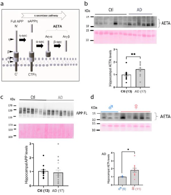 Figure from Acta Neuropathologica paper on Alzheimer's synaptic dysfunction