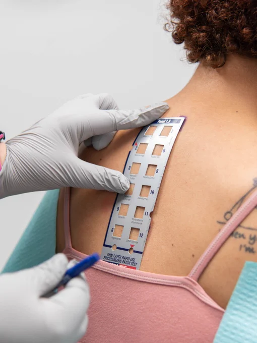 A close-up of a medical professional administering an allergy patch test on a person's shoulder. The person is wearing a pink camisole, and the practitioner's hands are gloved, holding a marked patch test panel.