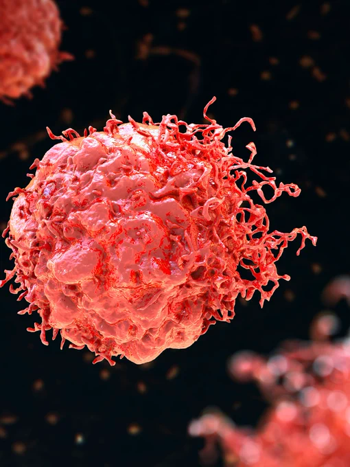 Microscopic image of a red, spherical cancer cell with irregular surface texture, surrounded by thin, hair-like structures. The background is dark, highlighting the cell's vivid color and detail.