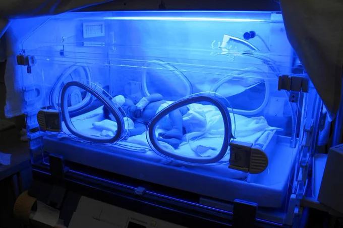 Recém-nascido de fralda e proteção nos olhos deitado sob luz azul intensa no interior de uma incubadora hospitalar transparente. Imagem ilustrativa: zoomstudio/Canva.