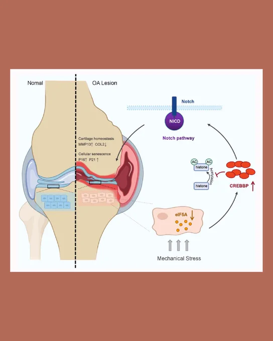 Diagram depicts model of the specific mechanisms by which eukaryotic translation initiation factor 5A (eIF5A) regulates chondrocyte homeostasis under mechanical
loading. 