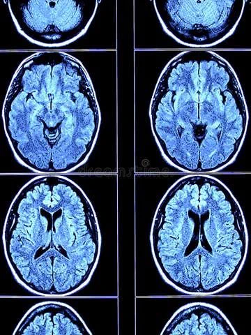 SHOCKING🚨: Neuroscience confirms that brains cells are directly influenced by self-talk, the internal dialogue or conscious thoughts