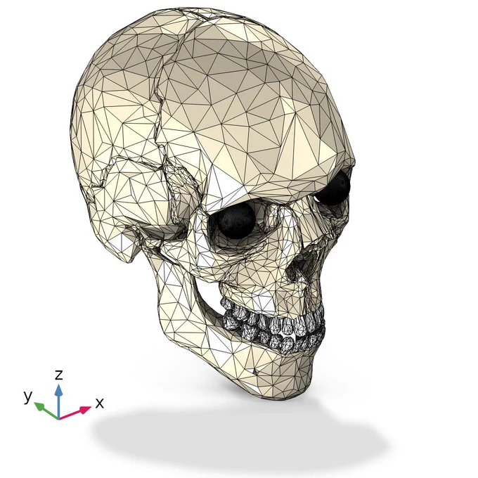 Integración de un Implante CAD en un escáner de cráneo con COMSOL Multiphysics®