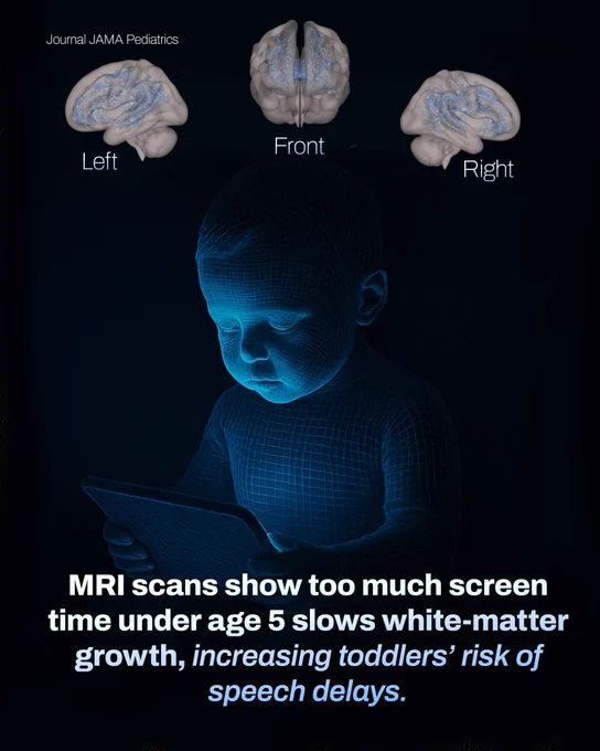 Excessive screen time before age five has been linked to slower growth of white-matter pathways in the developing brain. These pathways are essential for language, literacy, and cognitive processing, making their healthy development crucial during early childhood. 

MRI scans reviewed in a study published in JAMA Pediatrics show that children with higher screen exposure demonstrate reduced white-matter integrity. As a result, toddlers may face an increased risk of speech delays and difficulties in communication. The findings highlight the importance of mindful screen-use habits during the early years to support optimal brain development.