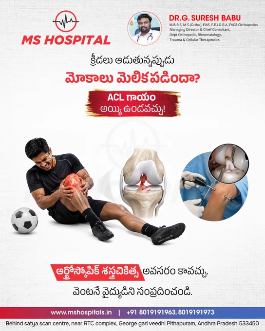 ⚽ Knee pain after a sudden twist, jump, or sports injury? It could be an ACL (Anterior Cruciate Ligament) tear.

An ACL injury can cause severe knee pain, swelling, instability, and difficulty walking. Early diagnosis and appropriate treatment can help restore knee function and get you back to your active lifestyle.

✅ Persistent knee pain should never be ignored.
✅ Arthroscopic surgery offers a minimally invasive treatment option for ACL injuries.
✅ Consult an orthopedic specialist for timely evaluation and care.

👨‍⚕️ Consult Dr. G. Suresh Babu
M.B.B.S, M.S (Ortho), FIAS, F.E.I.O.R.A, FAGE Orthopedics
Managing Director & Chief Consultant
Dept. Orthopedic, Rheumatology, Trauma & Cellular Therapeutics

📍 MS Hospital, Pithapuram
🌐 www.mshospitals.in
📞  91 8019191963,  91 8019191973

Follow us on our social media pages for more details:
Facebook: https://www.facebook.com/MSMultiSpeciality/
Instagram https://www.instagram.com/ms_hospitals//

#MSHospital #ACLInjury #KneePain #Sports