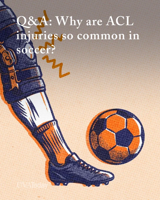 Illustration of a leg in a knee brace and black soccer cleat approaching a soccer ball. Text at the top reads: "Q&A: Why are ACL injuries so common in soccer?" with a "UVA Todat" logo in the corner.