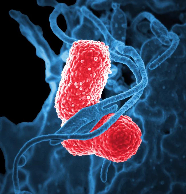 Microscopic image of MDR Klebsiella bacteria