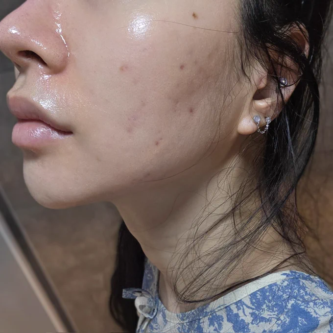 아이소이 흔적세럼 마일드랩 센텔라 오인트크림