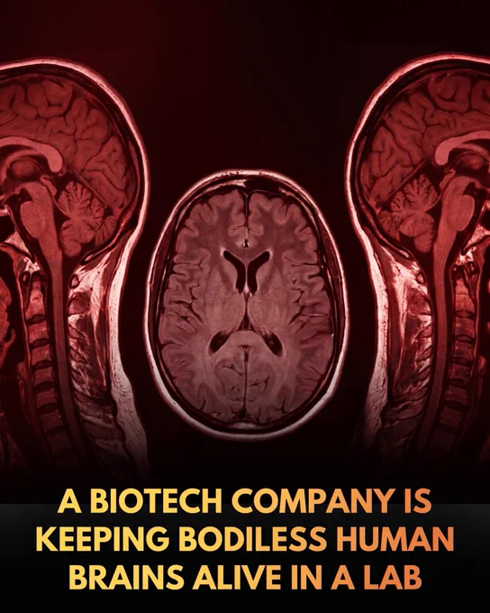 A biotech company is keeping recently deceased human brains active on a high-tech life-support system.

The reasons?

The company says they want to pave the way for an animal-free era of neurological drug testing.

Spun out of Yale University research, biotechnology startup Bexorg is challenging traditional drug testing boundaries by placing donated human brains on an artificial life-support system called BrainEx. 

Shortly after a donor's death, the company connects the bodiless organ to pumps that circulate an oxygen-rich, nutrient-dense blood substitute to restore cellular and metabolic activity. To address the immediate ethical concerns surrounding consciousness, Bexorg keeps these brains under deep anesthesia using propofol, ensuring there is no organized neural firing or awareness. 

The organs remain active for just 24 hours—providing researchers with a critical window to test drugs for diseases like Alzheimer's and Parkinson's on actual human tissue—before being dissected.