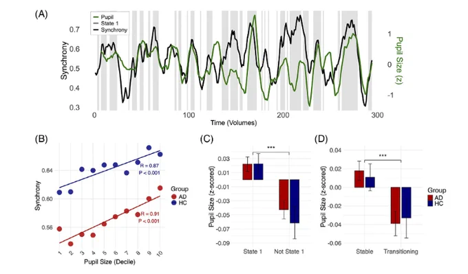 Four-panel figure showing that pupil size, a proxy for arousal, tracks cortical synchrony. An example timecourse shows pupil size (green) rising and falling with synchrony (black) and being higher during the brain’s global coherence state. Across participants, higher pupil size is associated with higher synchrony in both the Alzheimer’s and control groups, and pupil size is greater during the global coherence state and during stable, non-transitioning periods.