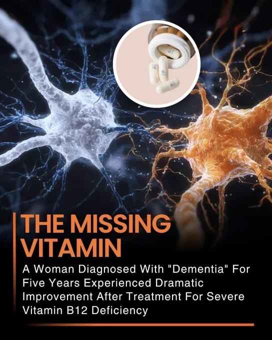 🚨 IT LOOKED LIKE DEMENTIA... BUT THE REAL CAUSE WAS HIDDEN!
A woman spent years battling memory loss and confusion that seemed like dementia. Then doctors made a surprising discovery — a severe Vitamin B12 deficiency.
After treatment, her symptoms improved dramatically, showing that some cases of cognitive decline may have a treatable cause. A simple vitamin played a much bigger role than anyone expected.

Source :
National Institute on Aging. Dementia and reversible causes of cognitive impairment