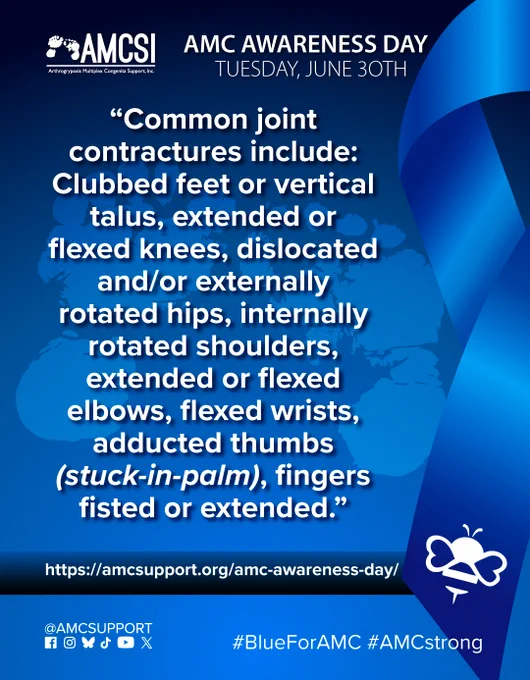 The AMCSI logo is small, white, in the upper-left corner & the background is a dark blue-to-blue circular gradient. It says ‘AMC AWARENESS DAY TUESDAY, JUNE 30TH’ in white, big lettering next to the AMCSI logo, with a ghosted image of teh AMCSI logo feet and the AMC Fact “Common joint contractures include: Clubbed feet or vertical talus, extended or flexed knees, dislocated and/or externally rotated hips, internally rotated shoulders, extended or flexed elbows, flexed wrists, adducted thumbs (stuck-in-palm), fingers fisted or extended.” written above everything, in bold white lettering, with a large blue ribbon on the right & the white bumblebee on the bottom left corner of it. Near the bottom is a blue-to-dark-blue gradient bar that runs behind the ribbon on the right & all the entire width, with the AMC Awareness Day AMCSI website link "https://amcsupport.org/amc-awareness-day/" in bold white lettering across it. At the bottom right are the social logos.