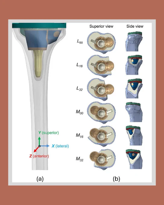 Image depicts tibial implant configuration and defect modelling.