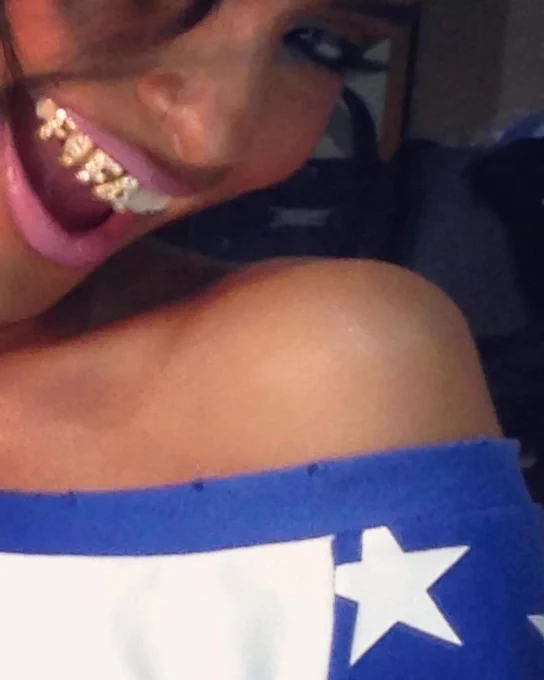 Close-up of a woman's face with a big smile, showing a gold grill on her teeth. She wears a blue and white star-patterned outfit.