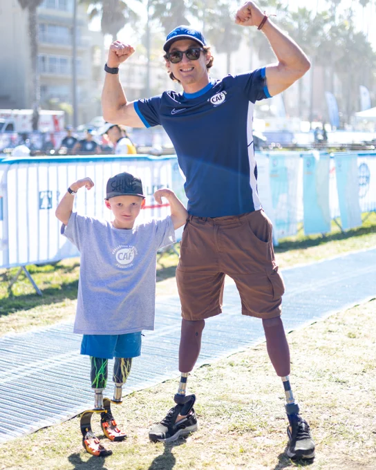 A man and young boy with prosthetic legs smile outdoors and flex their arms together at a sunny event.